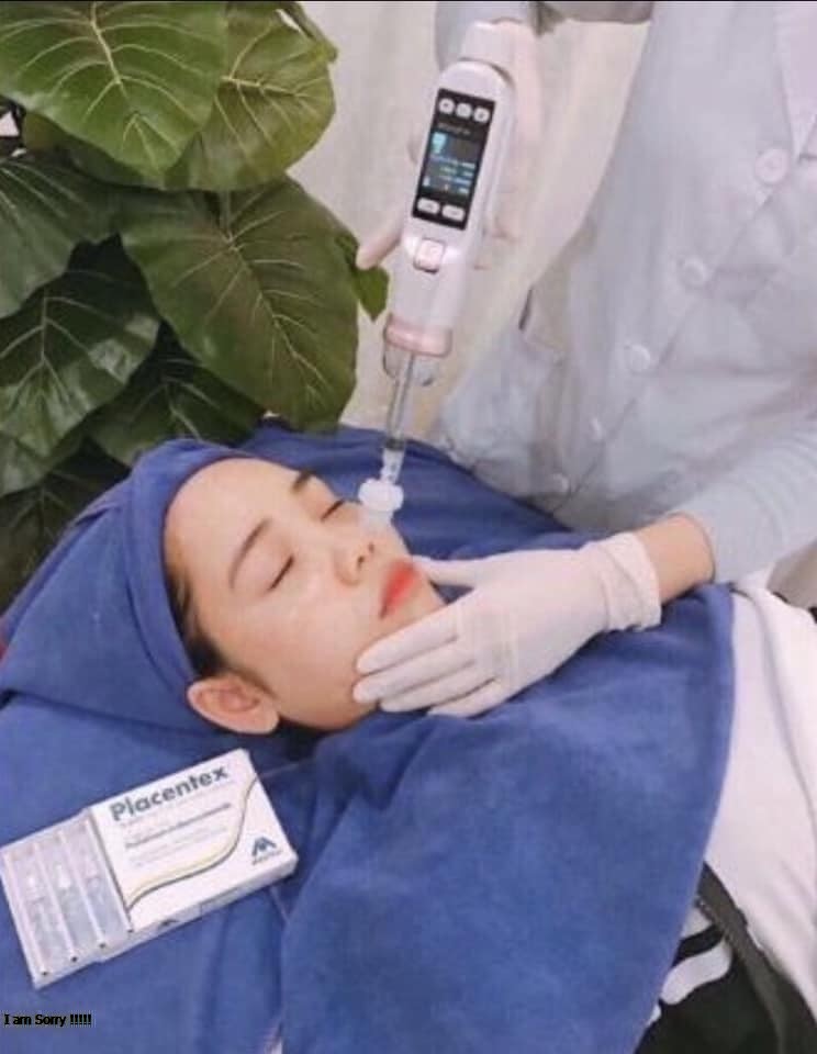 Máy cấy tính chất spa 