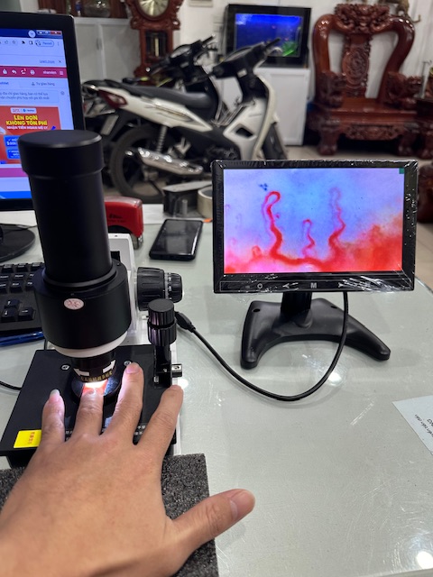 Máy soi vì tuần hoàn máu SK-8A phiên bản mới sắc nét phân giải cao